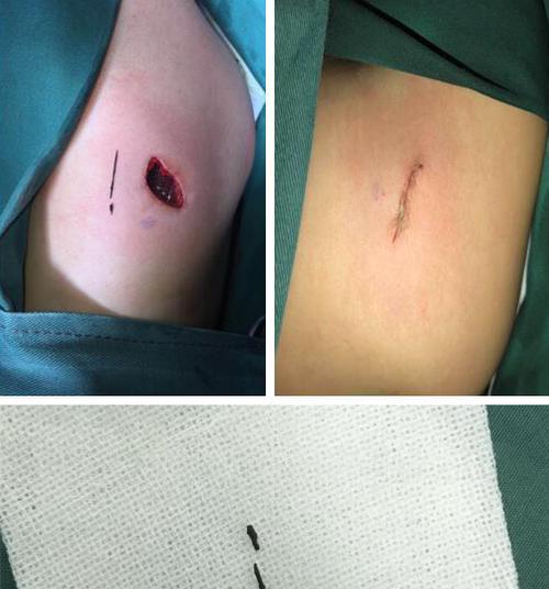 MySQL修改root密码的3种好用方案